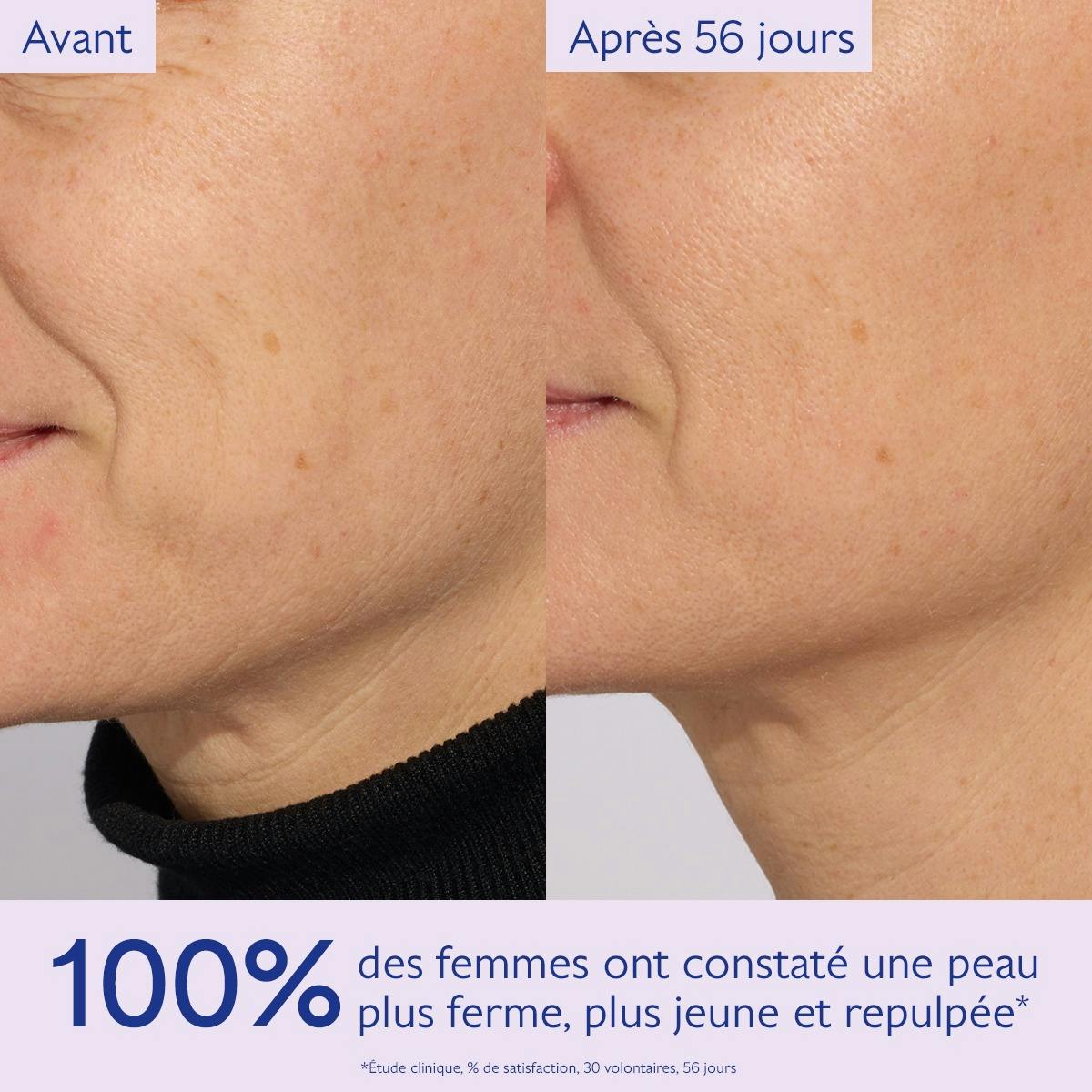 CAUDALIE COFFRET RESVERATROL-LIFT LA SOLUTION FERMETE