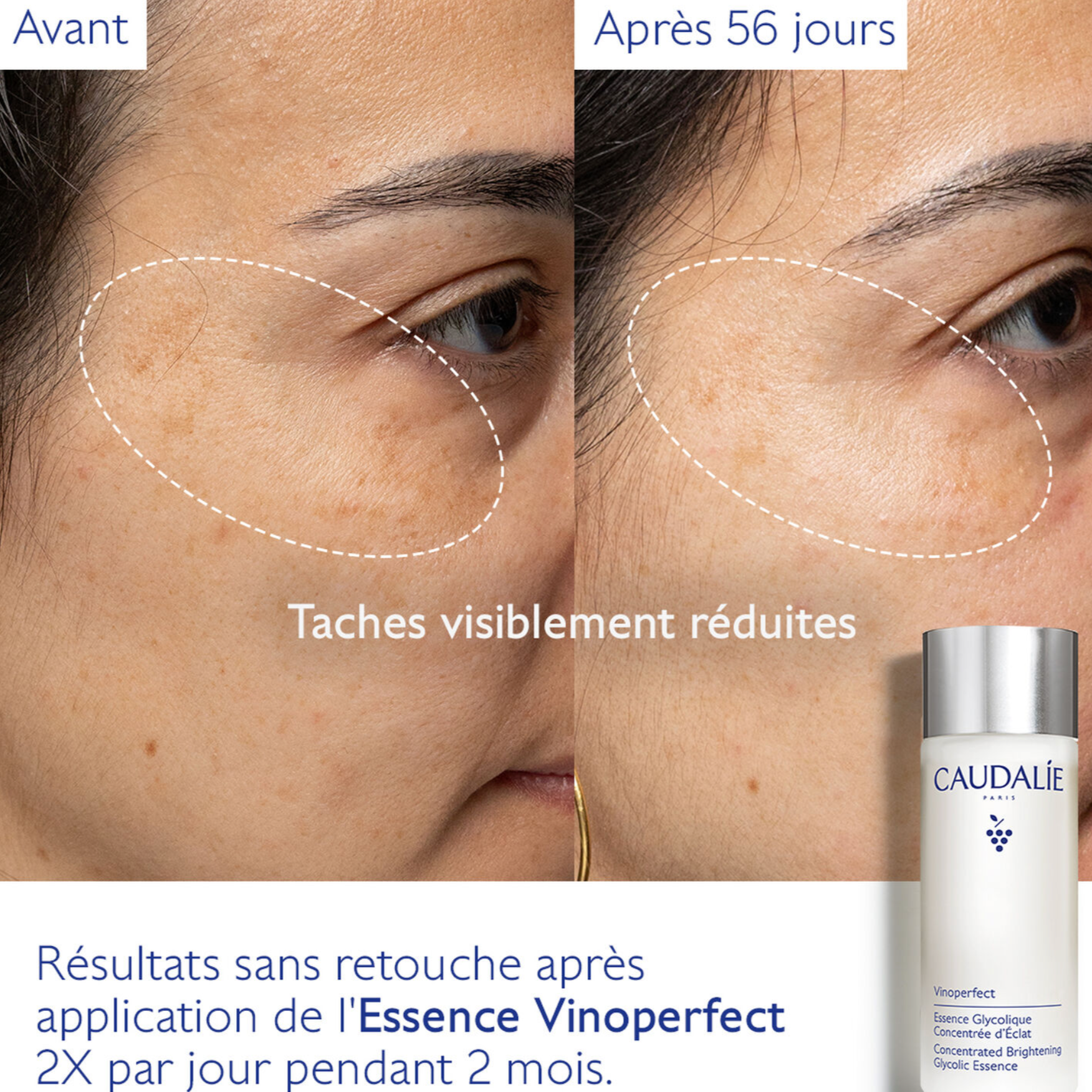 CAUDALIE ESSENCE GLYCOLIQUE VINOPERFECT 100ML