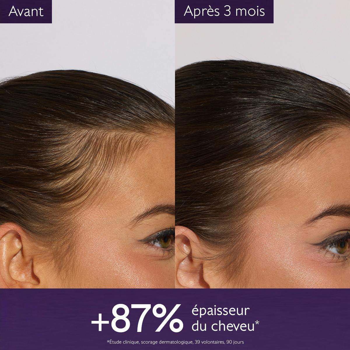 CAUDALIE SERUM CAPILLAIRE ANTI-CHUTE 50ML