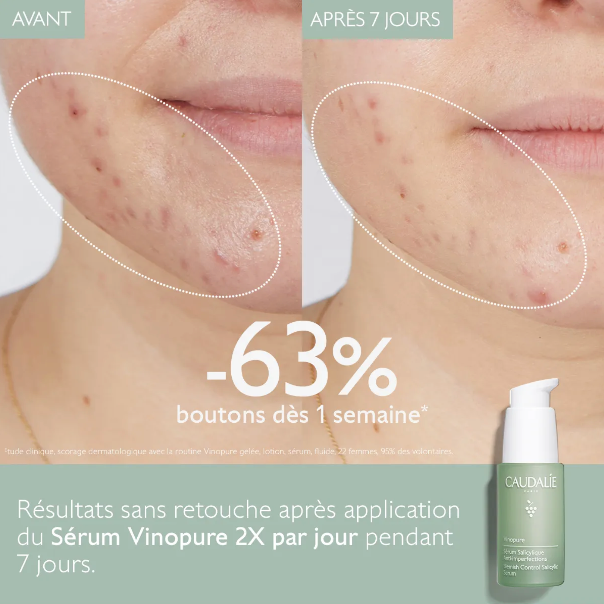 CAUDALIE VINOPURE SERUM SALICYLIQUE ANTIIMPERFECTIONS 30ML