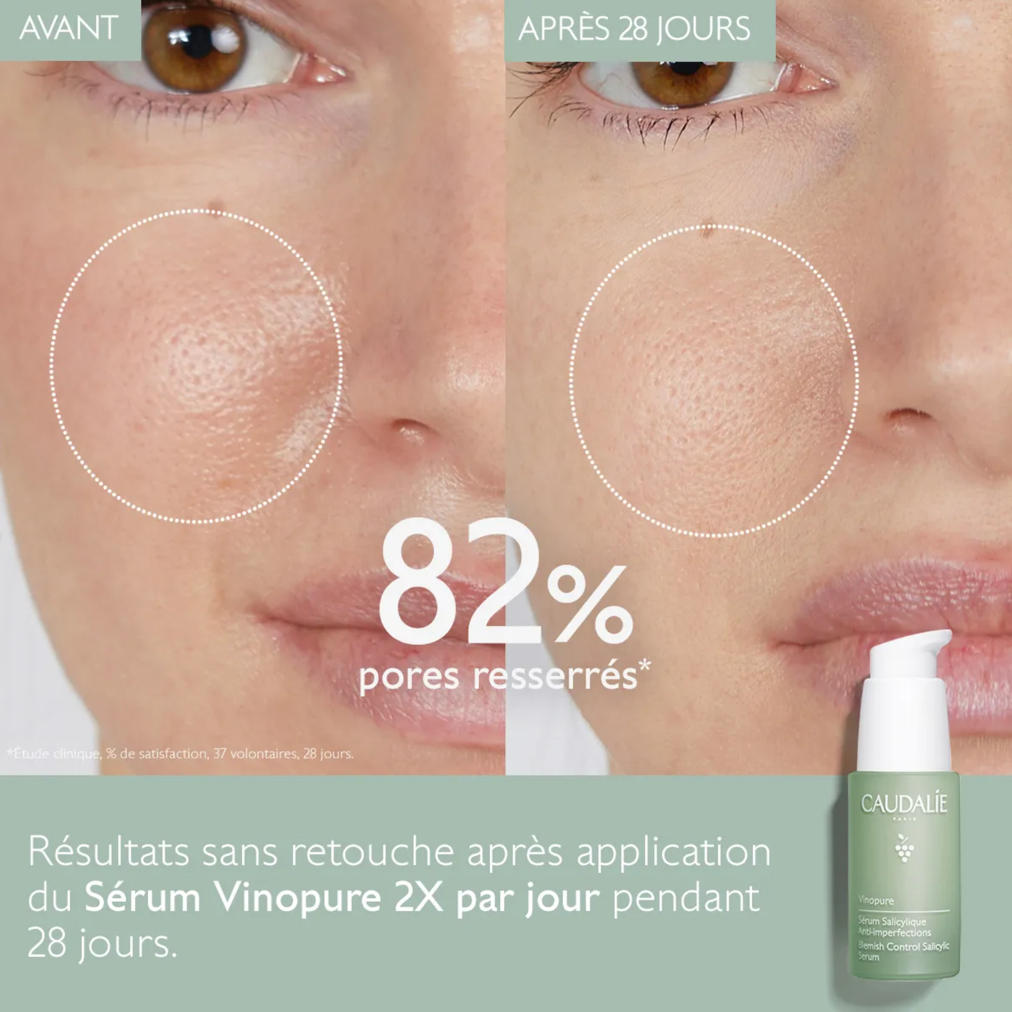 CAUDALIE VINOPURE SERUM SALICYLIQUE ANTIIMPERFECTIONS 30ML